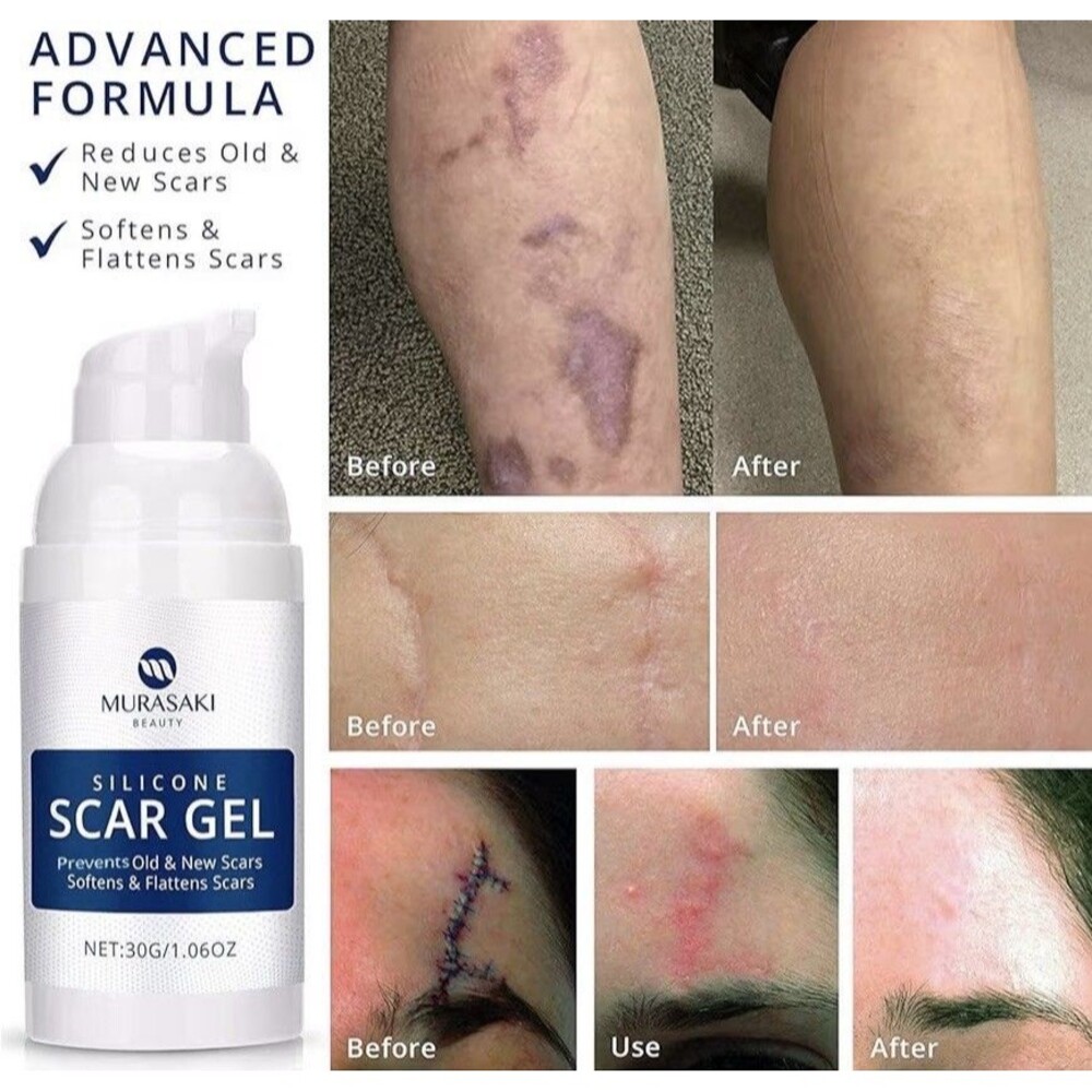100% Silicone Scar Gel 1 Count (Pack of 1), Maximum Strength